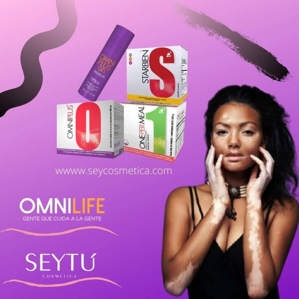 Vitíligo con Omnilife Seytú