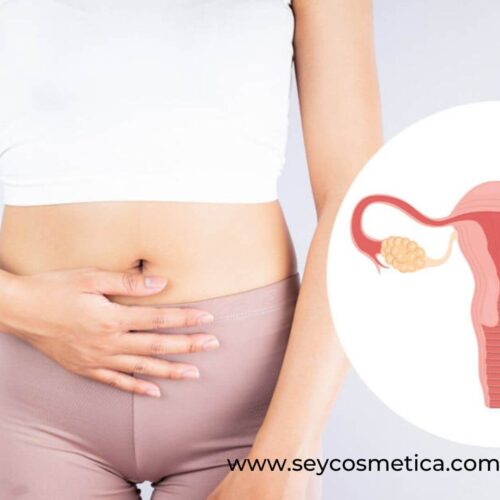 Síndrome de Ovario Poliquístico y suplementos alimenticios